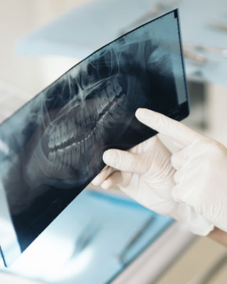 Röntgenbild von Zähnen und Kiefer