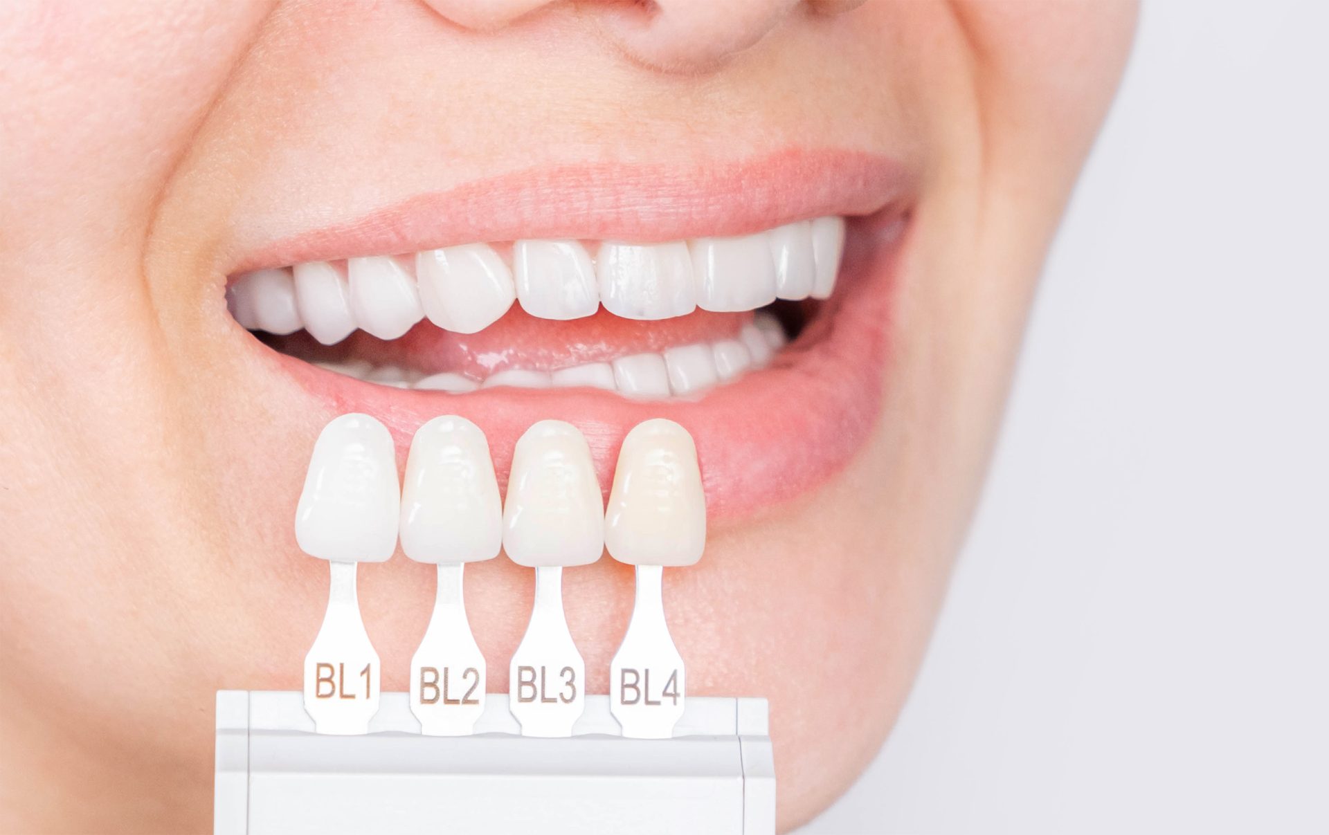 Schöne Zähne/Zahnästhetik im ZfZW