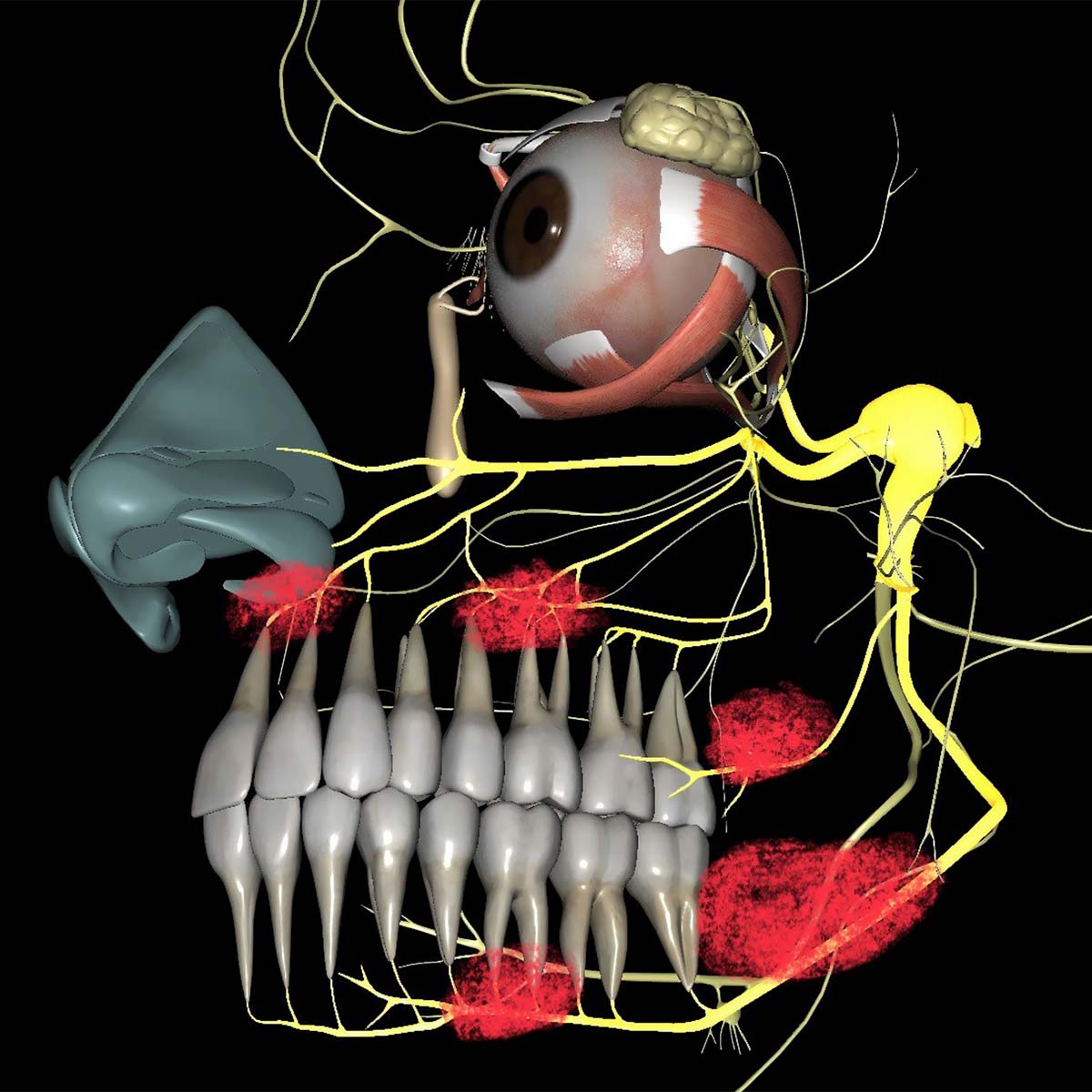 NICO nervus trigeminus